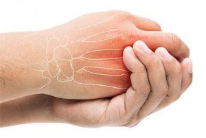 hand pain, finger pain, finger pain rehab